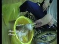 ЖЕСТЬ!  так гниют наркоманы