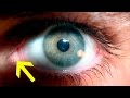 10 ненужных органов человека